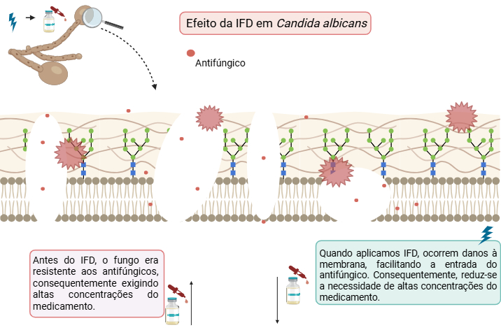 Terapia a laser potencializa tratamento contra fungo resistente a medicamento convencional